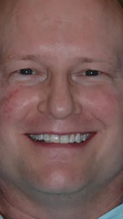 Smile before cosmetic dental treatment