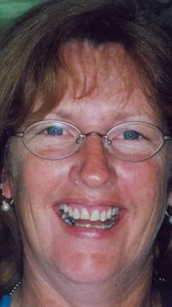 Smile before cosmetic dental treatment, gallery case 6